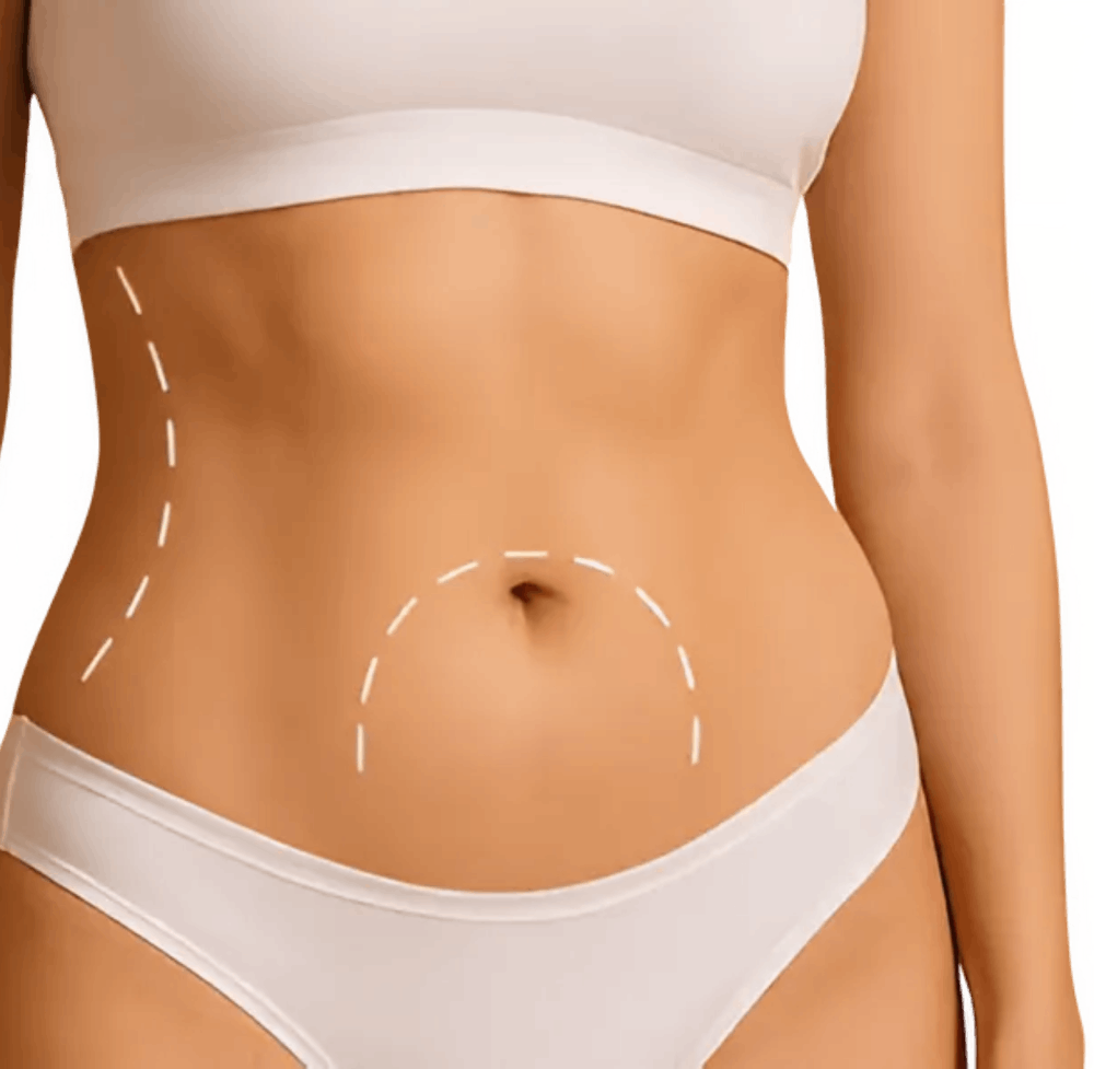Abdomen Liposuction-1
