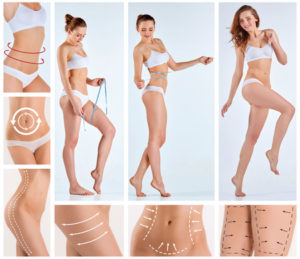 Liposuction Body Contouring