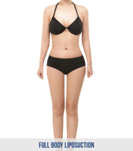 Full Body Liposuction Korea